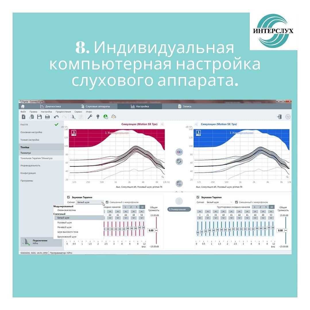 Как выбрать слуховой аппарат?